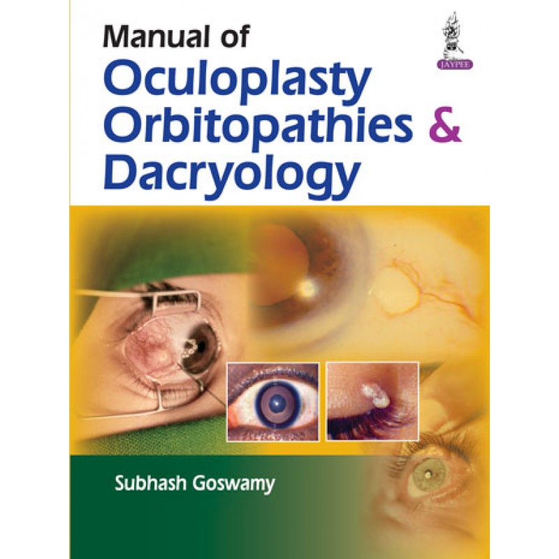 Manual of Oculoplasty, Orbitopathies  and  Dacryology