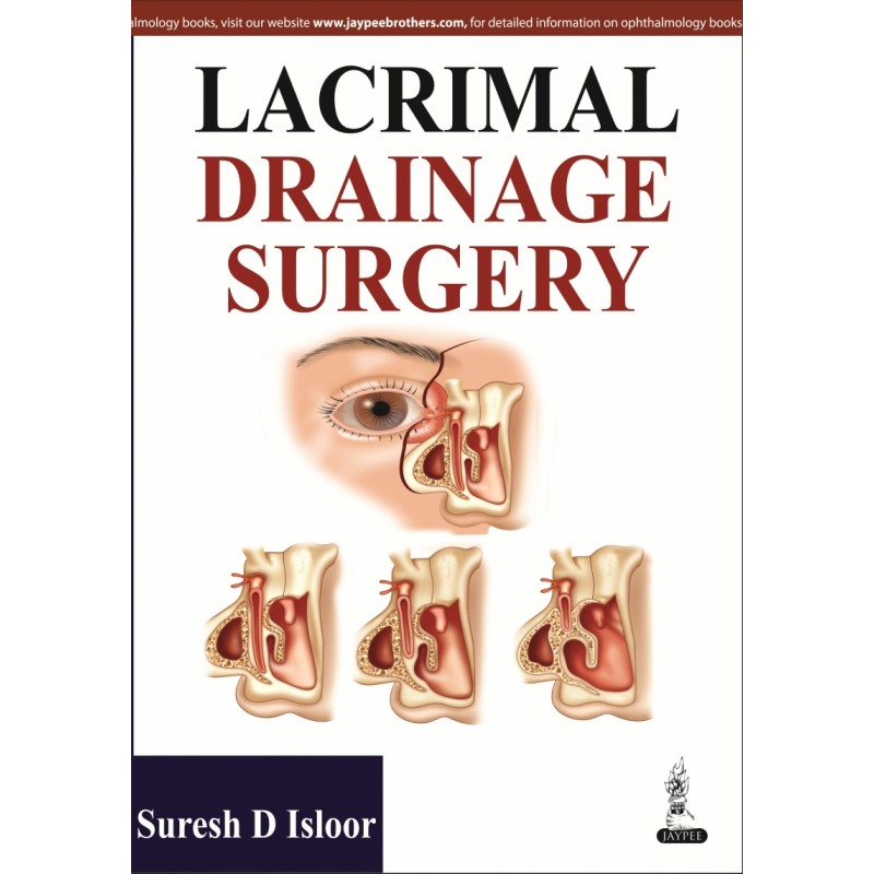 Lacrimal Drainage Surgery