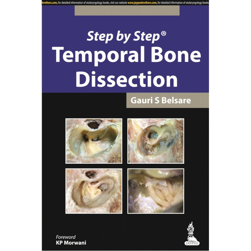 Step by Step: Temporal Bone Dissection