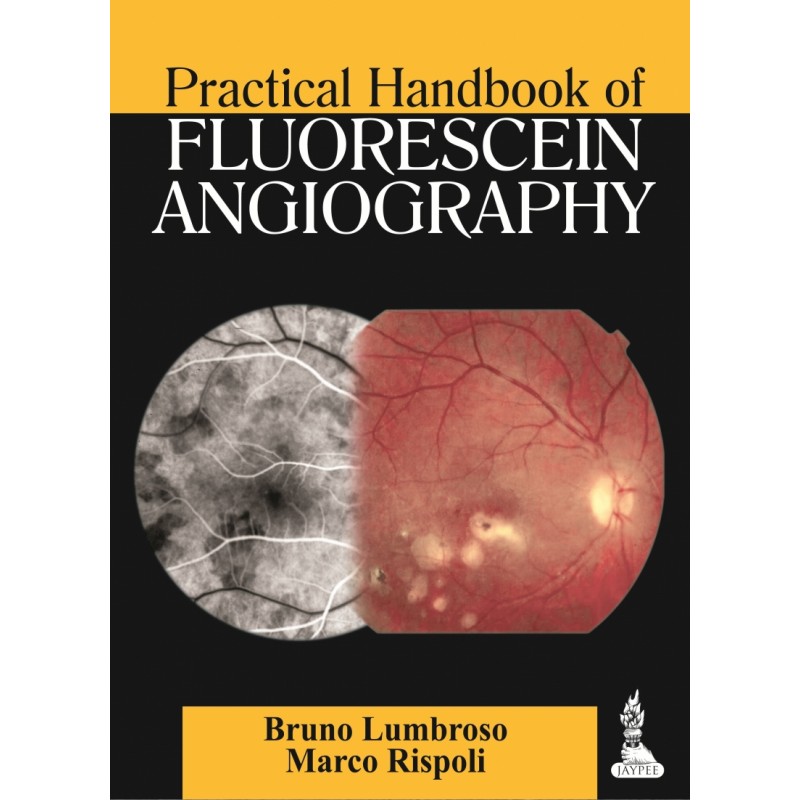 Practical Handbook of Fluorescein Angiography