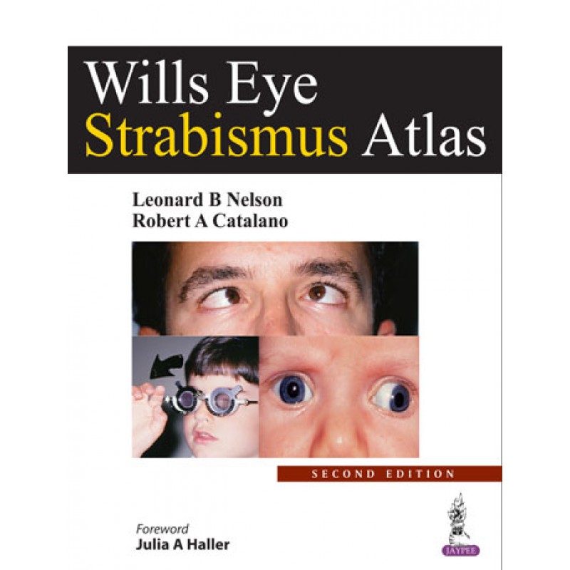 Wills Eye Strabismus Atlas