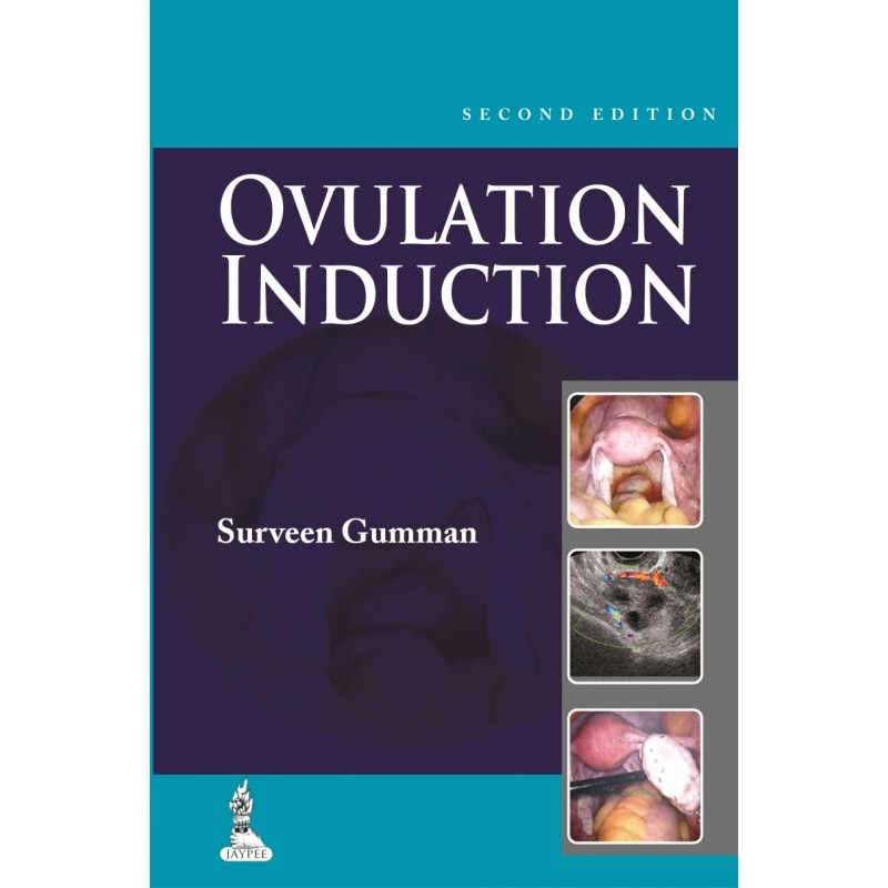 Ovulation Induction