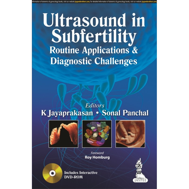 Ultrasound in Subfertility