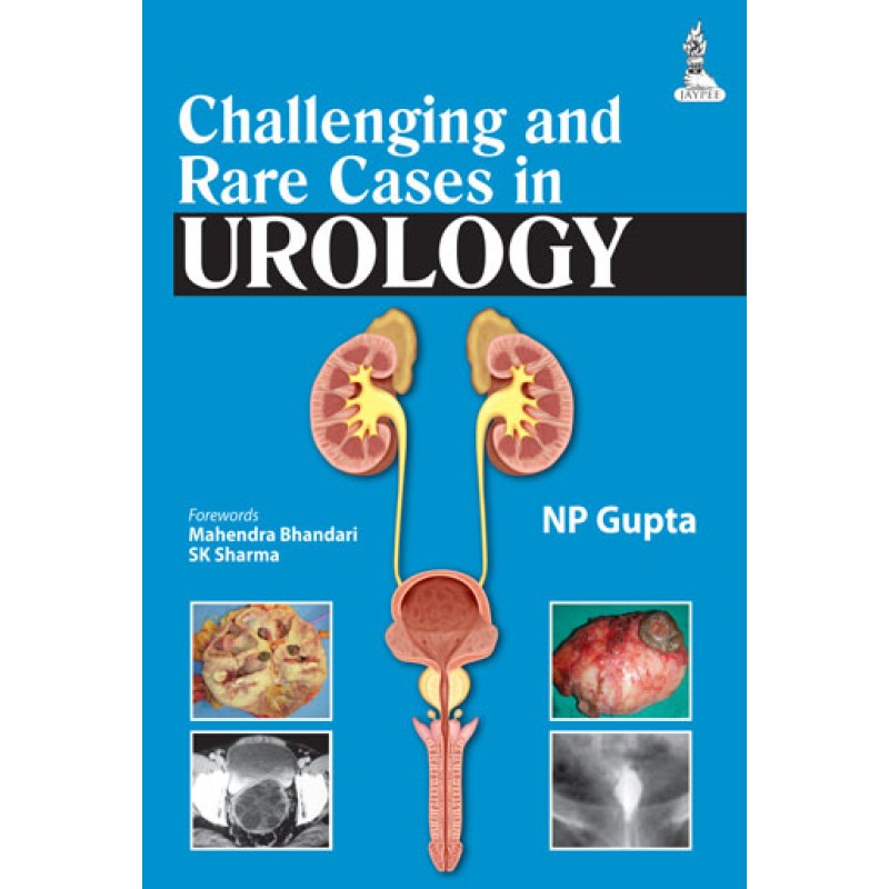 Challenging and Rare Cases in Urology
