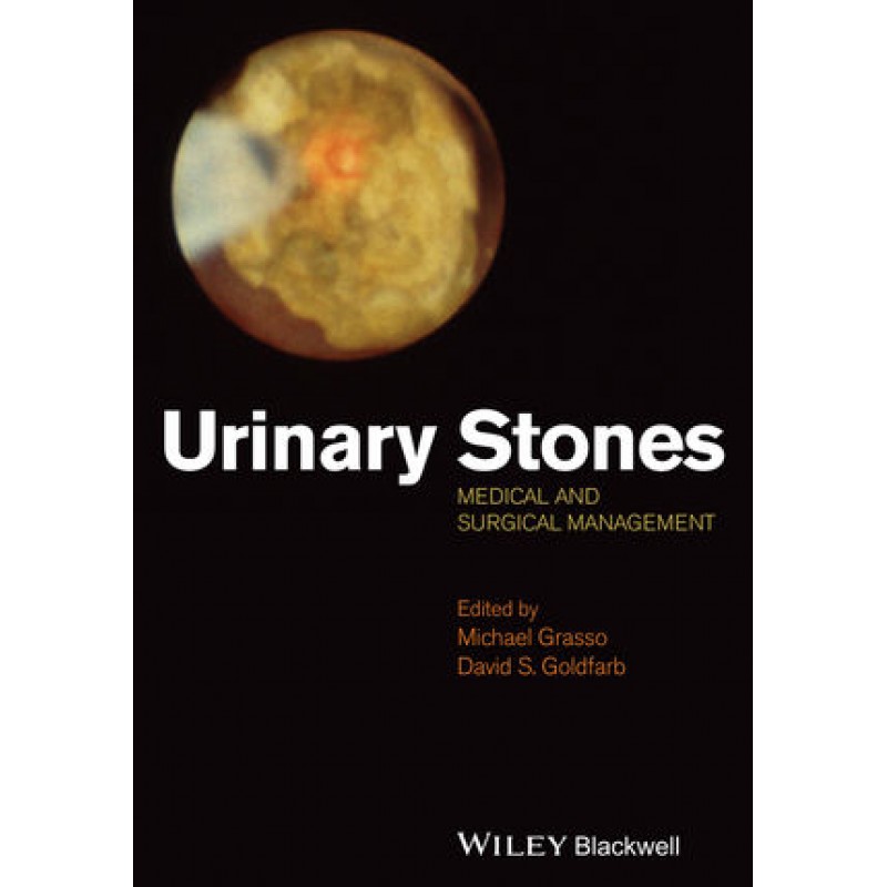 Urinary Stones: Medical and Surgical Management
