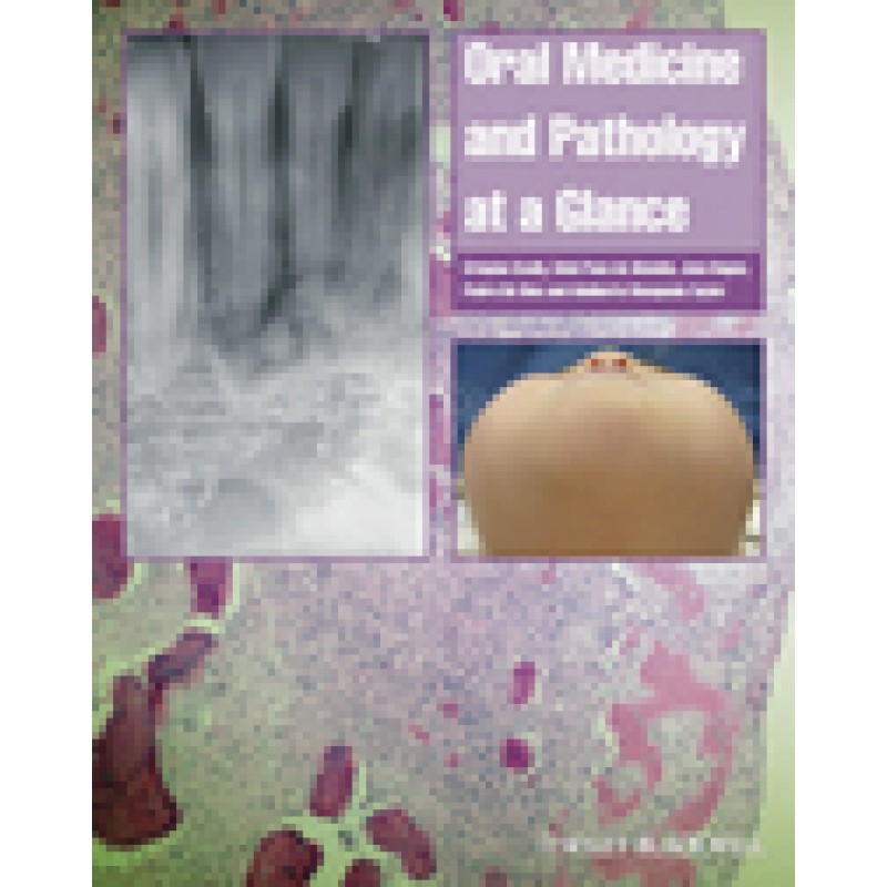 Oral Medicine and Pathology at a Glance