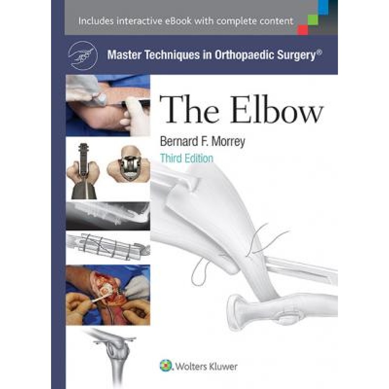 Master Techniques in Orthopaedic Surgery: The Elbow, 3e