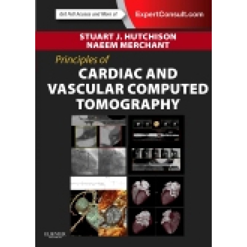 Principles of Cardiac and Vascular Computed Tomography