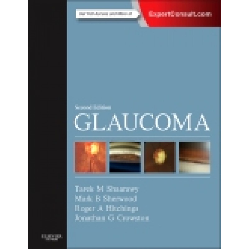 Glaucoma, 2nd Edition 2-Volume Set