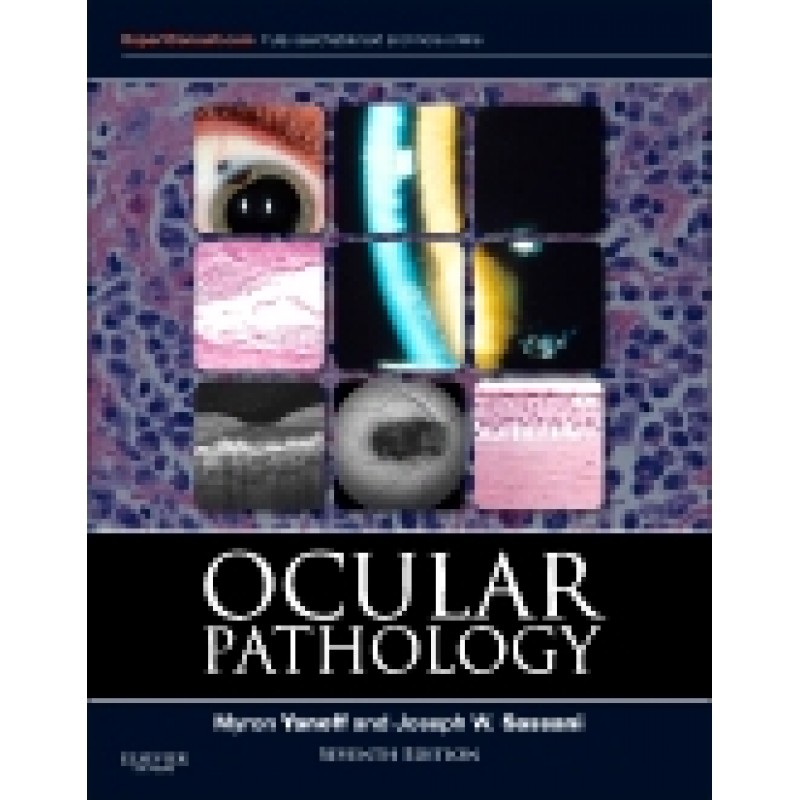 Ocular Pathology, 7th Edition Expert Consult - Online and Print
