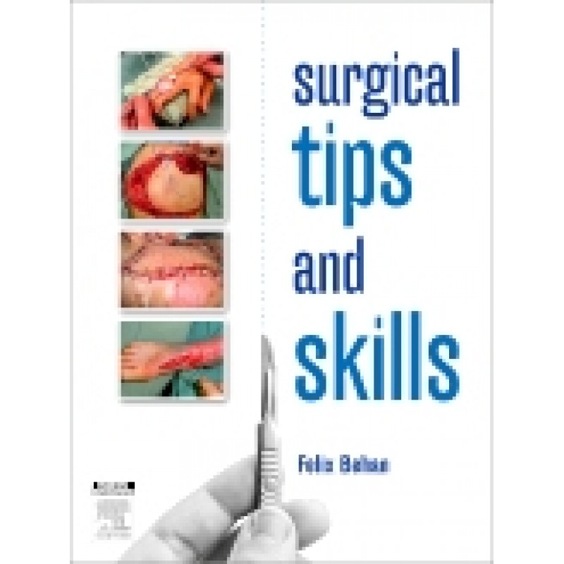 Surgical Tips and Skills