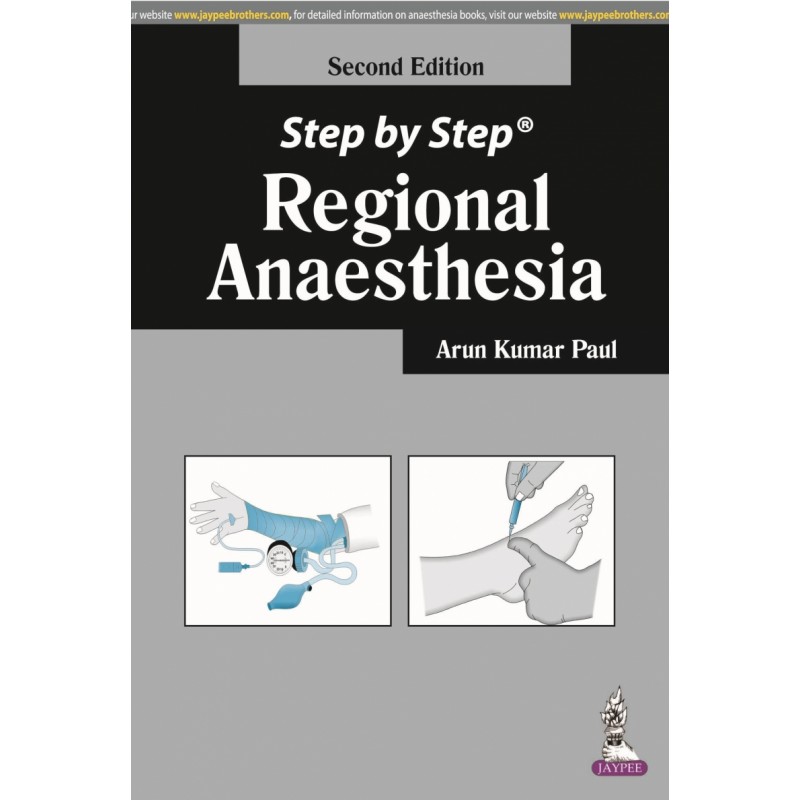 Step by Step: Regional Anaesthesia