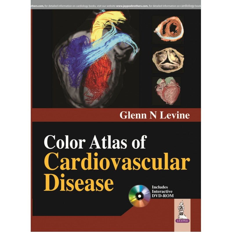 Color Atlas of Cardiovascular Disease