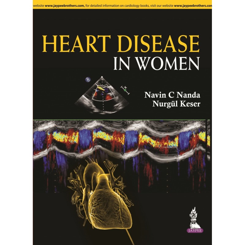 Heart Disease in Women