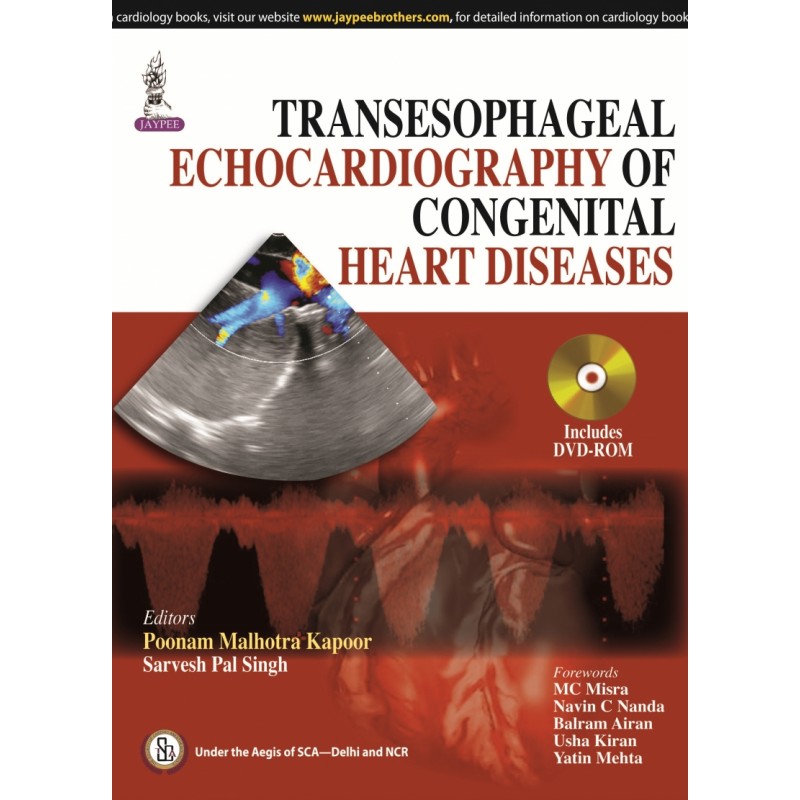 Transesophageal Echocardiography of Congenital Heart Diseases
