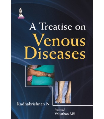 A Treatise on Venous Diseases