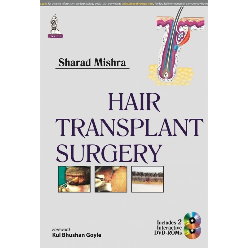 Hair Transplant Surgery