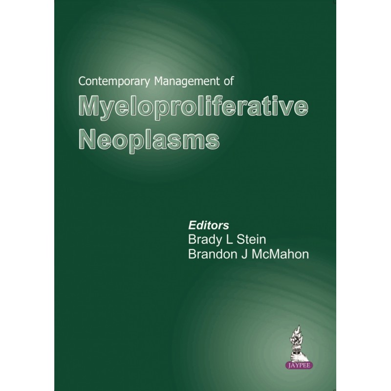 Contemporary Management of Myeloproliferative Neoplasms