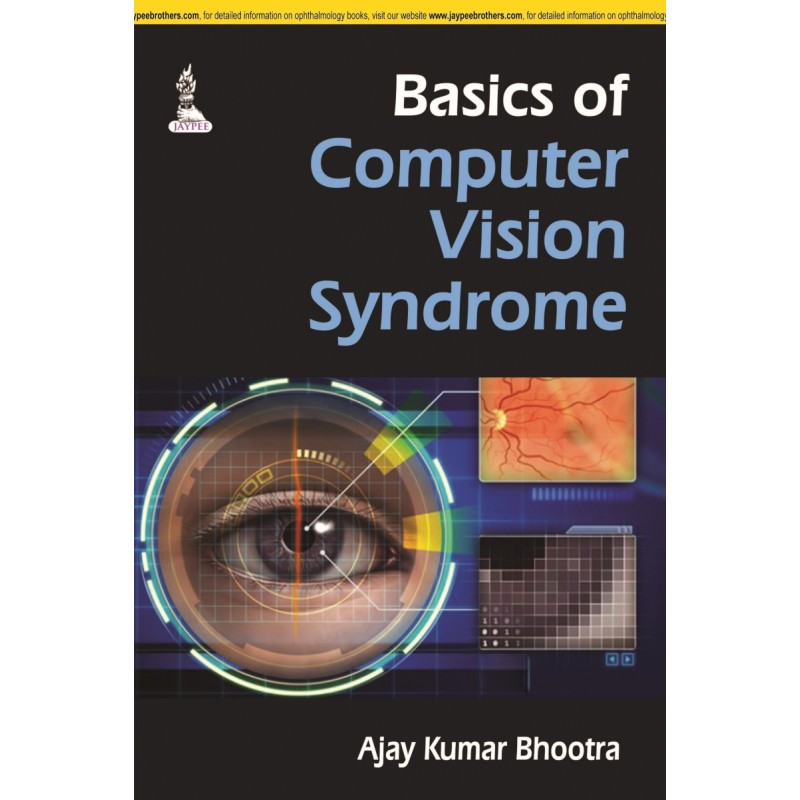 Basics of Computer Vision Syndrome