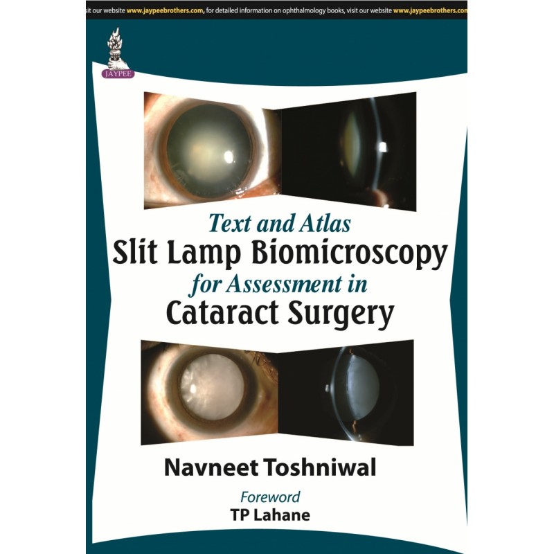 Text and Atlas: Slit Lamp Biomicroscopy for Assessment in Cataract Surgery