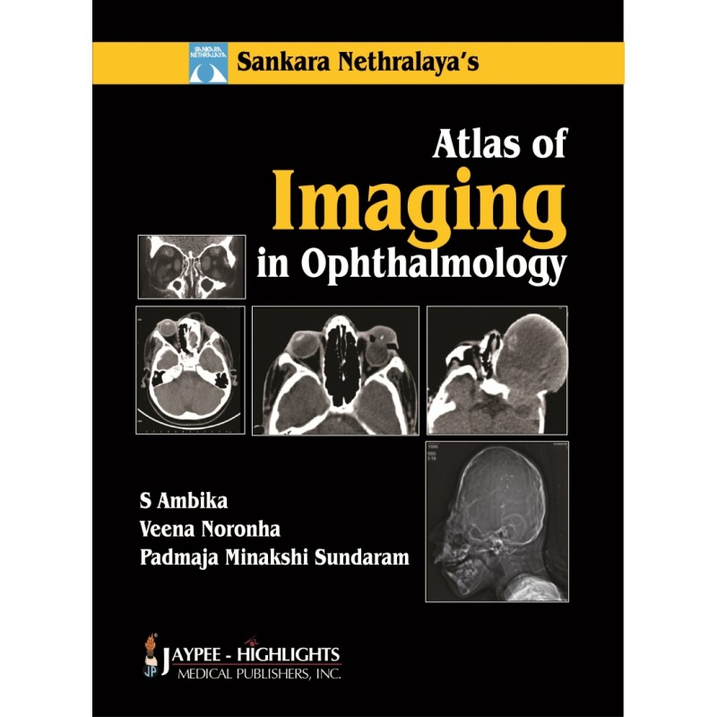 Atlas of Imaging in Ophthalmology