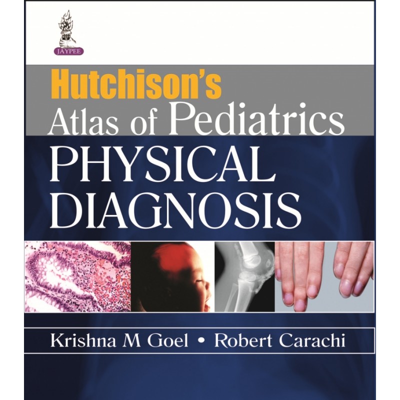 Hutchison's Atlas of Pediatric Physical Diagnosis