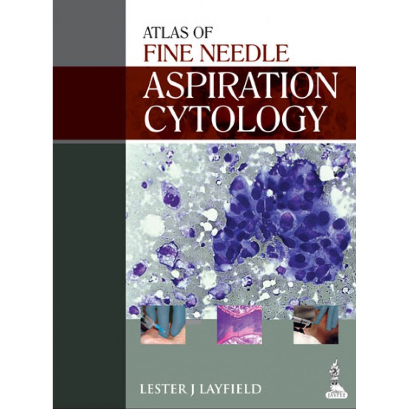 Atlas of Fine Needle Aspiration Cytology