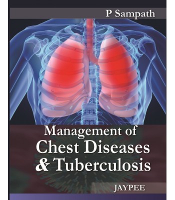 Management of Chest Diseases and Tuberculosis
