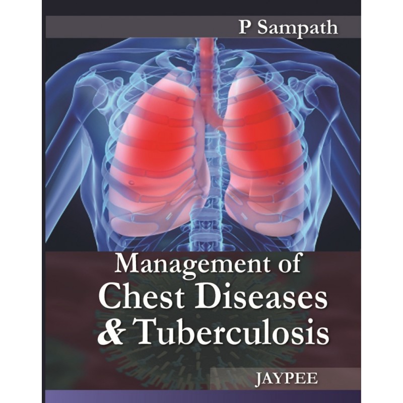 Management of Chest Diseases and Tuberculosis