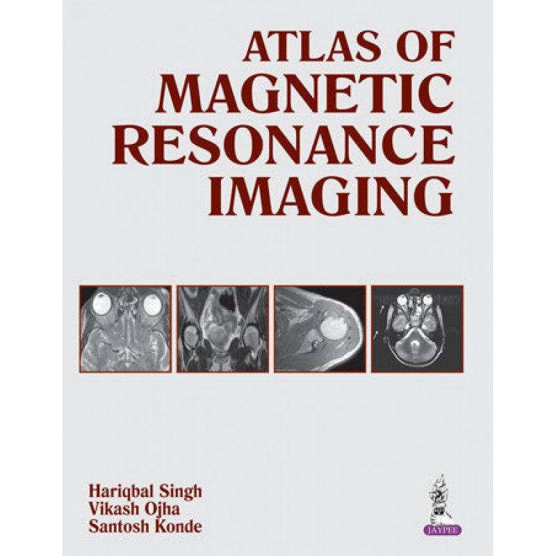 Atlas of Magnetic Resonance Imaging
