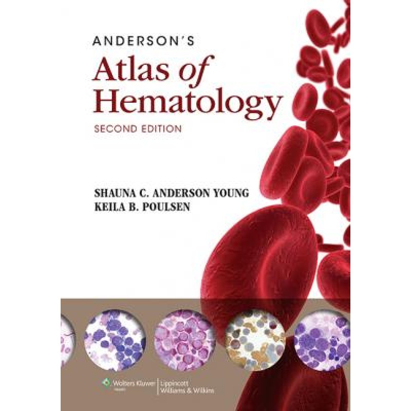 Anderson's Atlas of Hematology, 2e