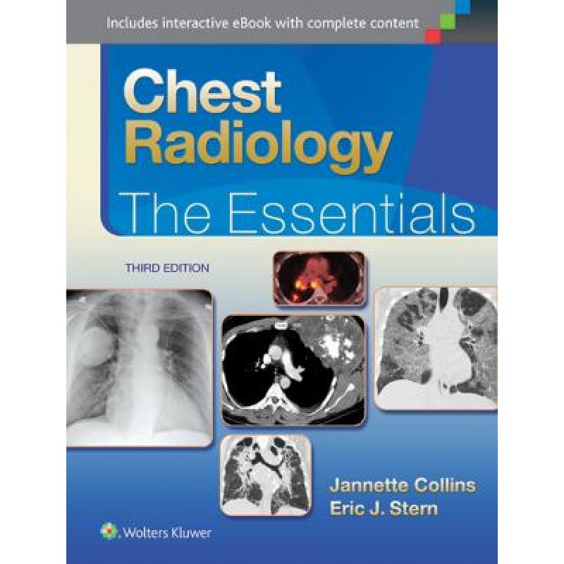 Chest Radiology, 3e THE ESSENTIALS