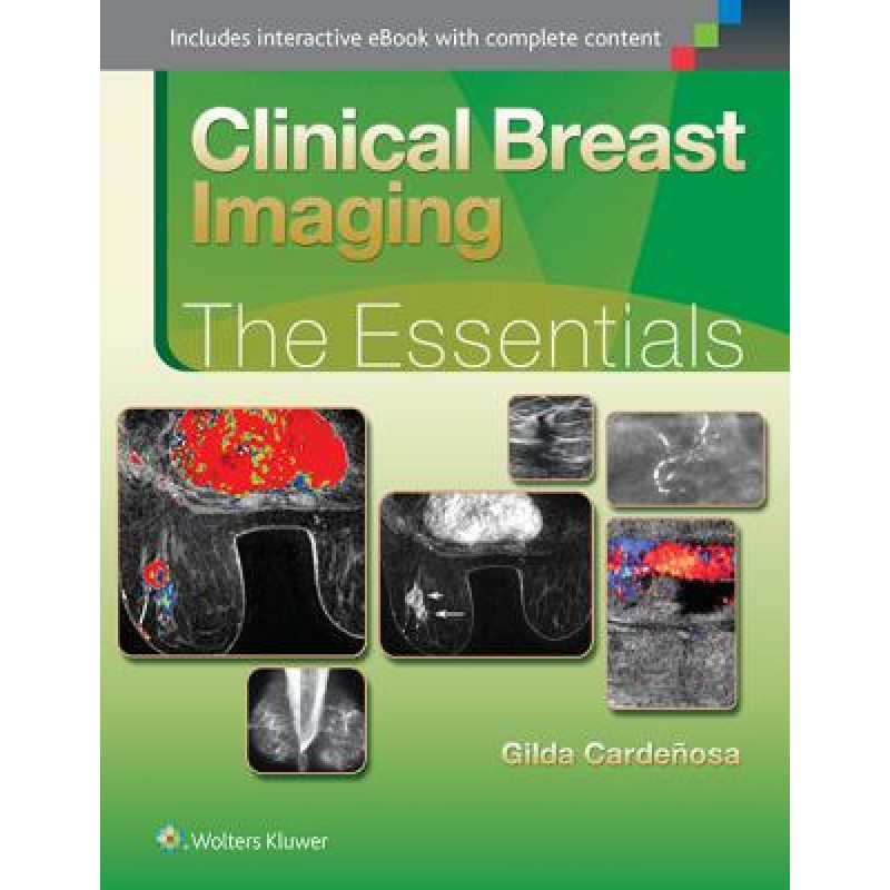 Clinical Breast Imaging THE ESSENTIALS