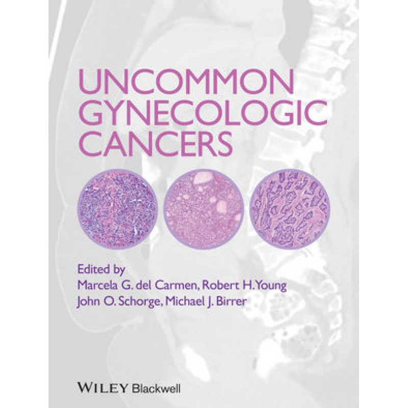 Uncommon Gynecologic Cancers