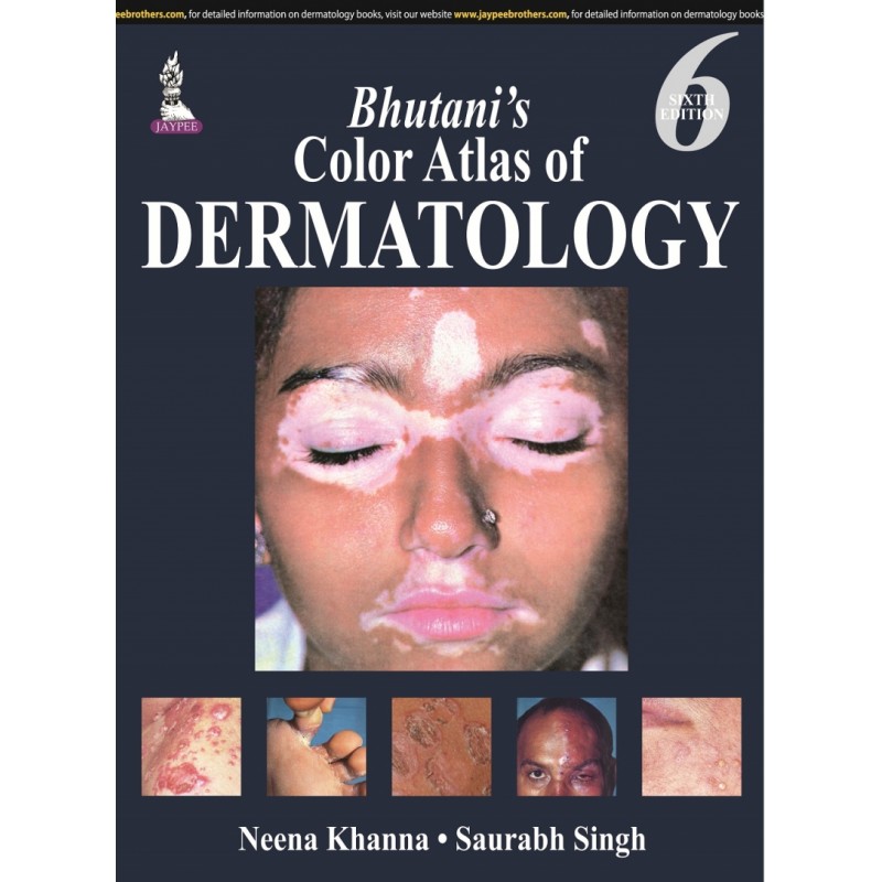 Bhutani’s Color Atlas of Dermatology