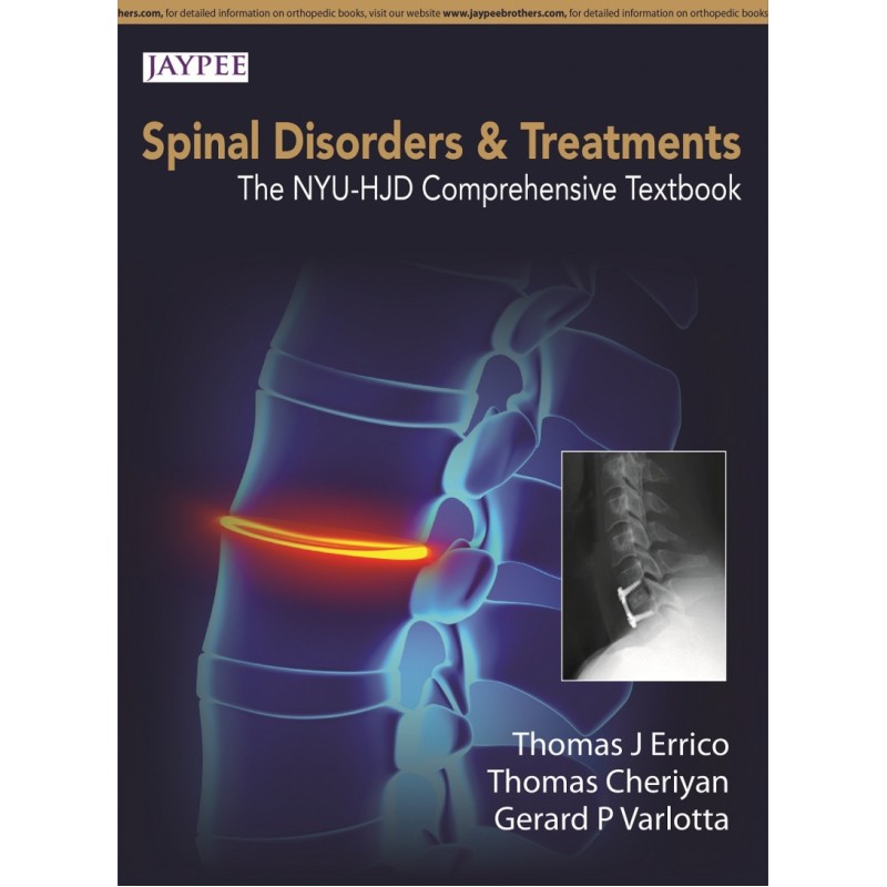 Spinal Disorders  and  Treatment: The NYU-HJD Comprehensive Textbook