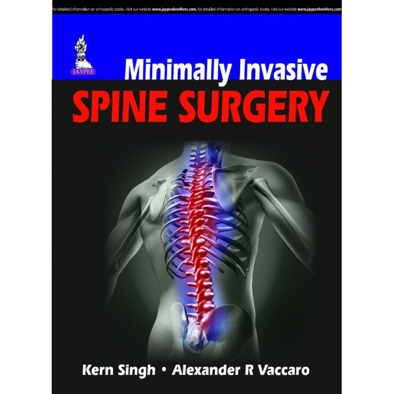 Minimally Invasive Spine Surgery