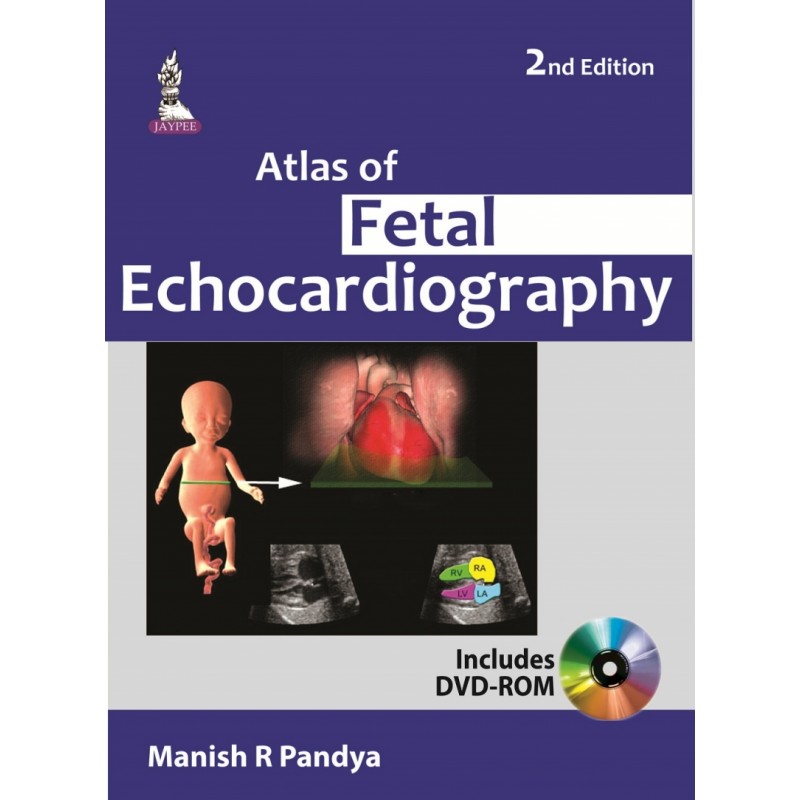Atlas of Fetal Echocardiography 2nd edition