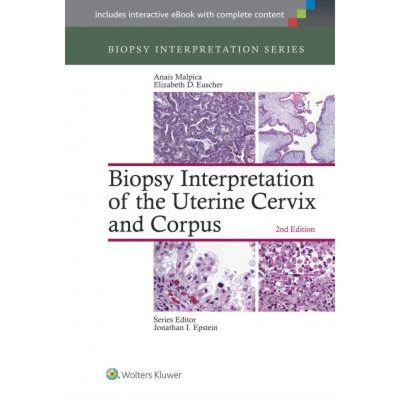 Biopsy Interpretation of the Uterine Cervix and Corpus, 2e