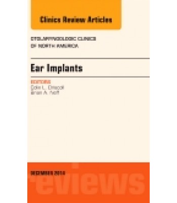 Ear Implants, An Issue of Otolaryngologic Clinics of North America, Volume 47-6