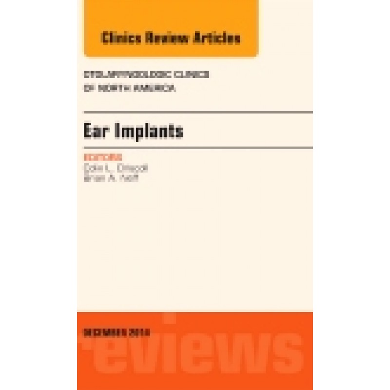 Ear Implants, An Issue of Otolaryngologic Clinics of North America, Volume 47-6