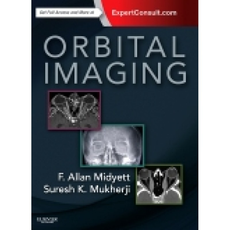 Orbital Imaging