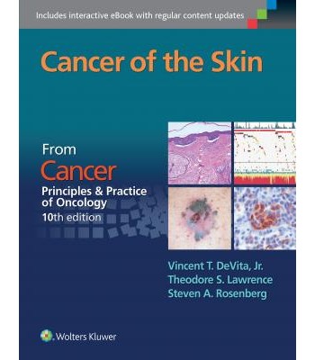 Cancer of the Skin FROM CANCER: PRINCIPLES &amp; PRACTICE OF ONCOLOGY, 10TH EDITION