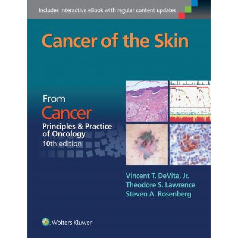 Cancer of the Skin FROM CANCER: PRINCIPLES  and PRACTICE OF ONCOLOGY, 10TH EDITION