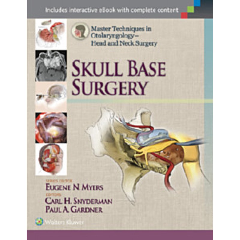 Master Techniques in Otolaryngology - Head and Neck Surgery: Skull Base Surgery