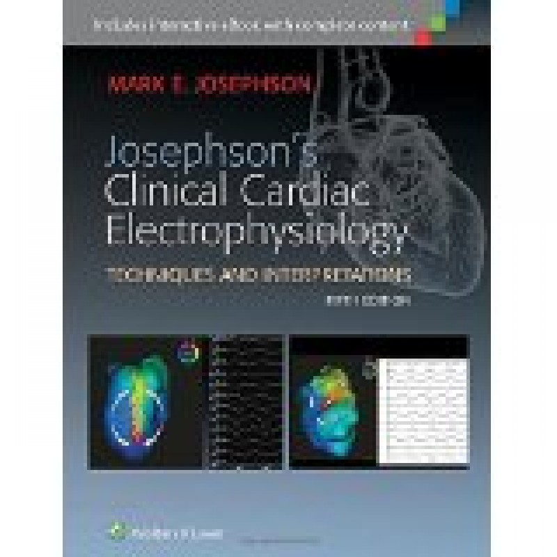 Josephson's Clinical Cardiac Electrophysiology, 5e