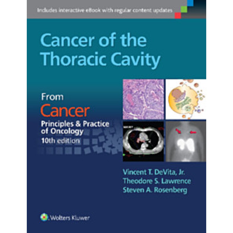 Cancer of the Thoracic Cavity CANCER: PRINCIPLES  and PRACTICE OF ONCOLOGY, 10TH EDITION