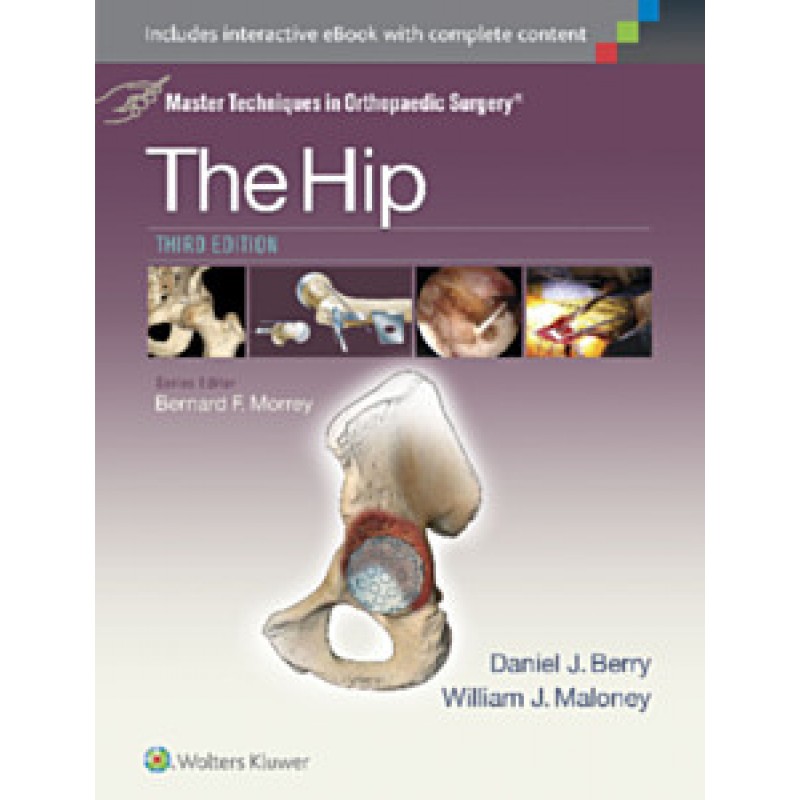 Master Techniques in Orthopaedic Surgery: The Hip, 3e