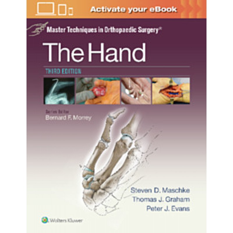 Master Techniques in Orthopaedic Surgery: The Hand, 3e