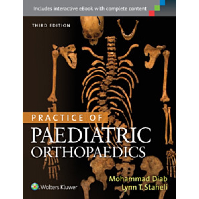 Practice of Paediatric Orthopaedics, 3e